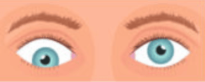 Hypotropia